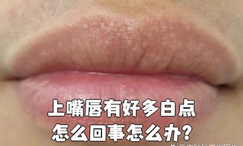 睡眠质量不好 如何改善-专业睡眠质量不好有什么办法可以调理平台-睡眠质量不好吃什么药效果最好